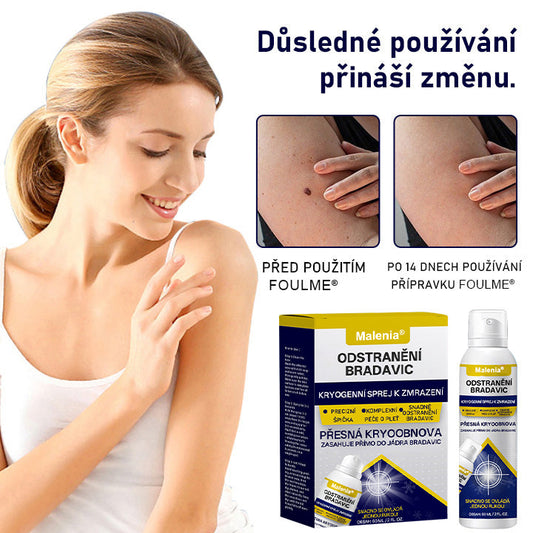 🔥🔥Malenia® WartErase Kryogenní sprej