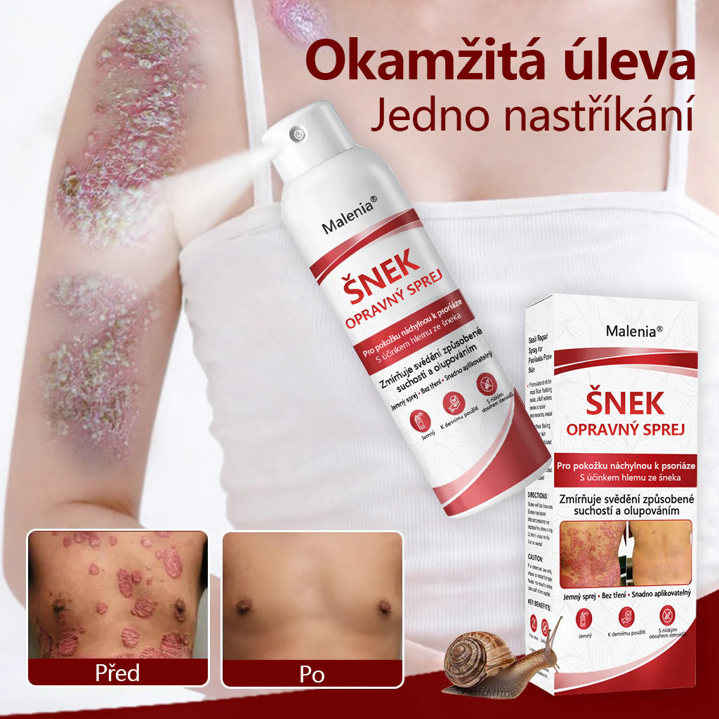 🔥Malenia® Snail Repair Spray pro svědivou, šupinatou pokožku s psoriázou