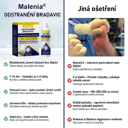🔥🔥Malenia® WartErase Kryogenní sprej