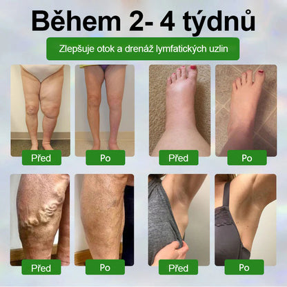 🌿🌿🌿Malenia® Bylinný krém zmírňující otoky s černuchou