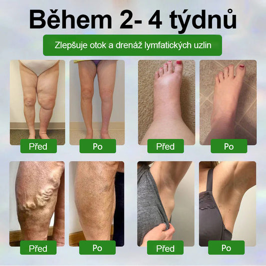 🌿🌿🌿Malenia® Bylinný krém zmírňující otoky s černuchou