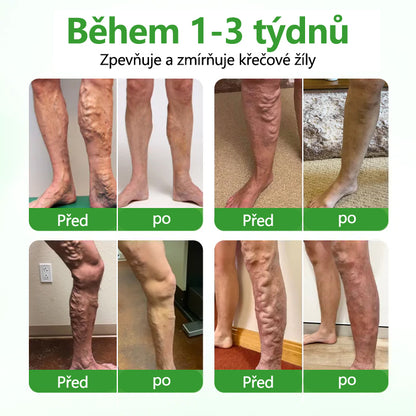 🌿Malenia® VeinHeal mikrojehličková náplast