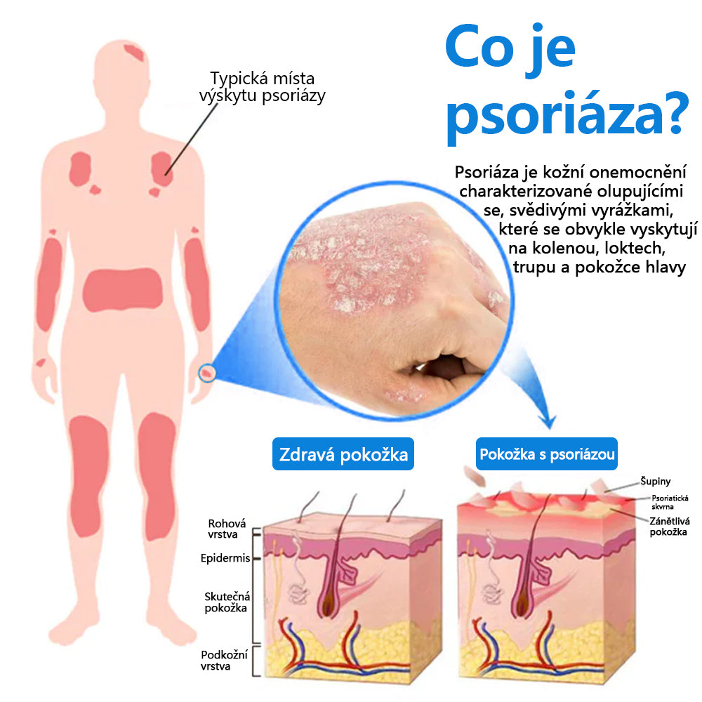 【Oficiální značkový obchod】✅✅Malenia® Magnesium bylinný sprej