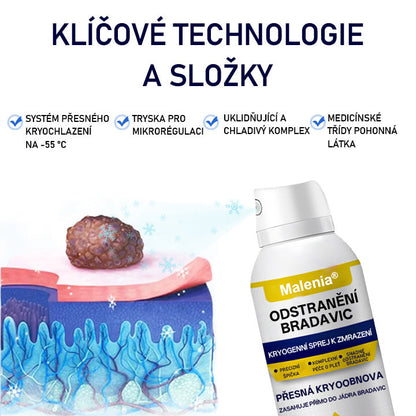🔥🔥Malenia® WartErase Kryogenní sprej