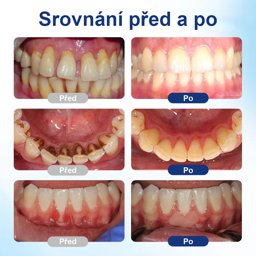 🔥🔥🔥🔥Malenia® BeeTakt Roztok pro ústní hygienu