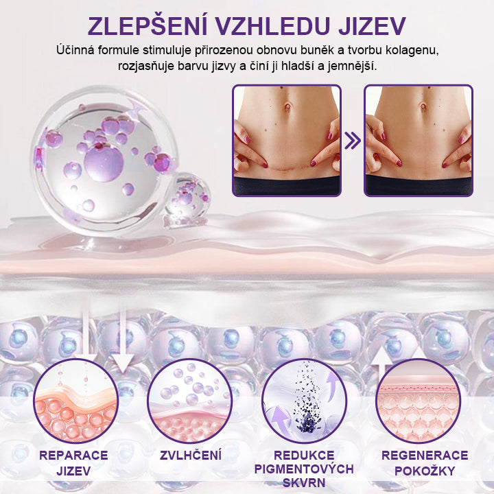 🔥🔥Malenia® ReGenScar Gel na jizvy s kmenovými buňkami