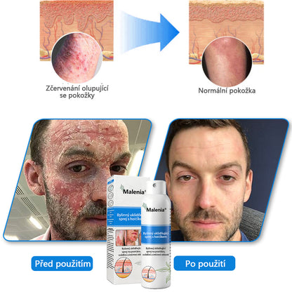 【Oficiální značkový obchod】✅✅Malenia® Magnesium bylinný sprej