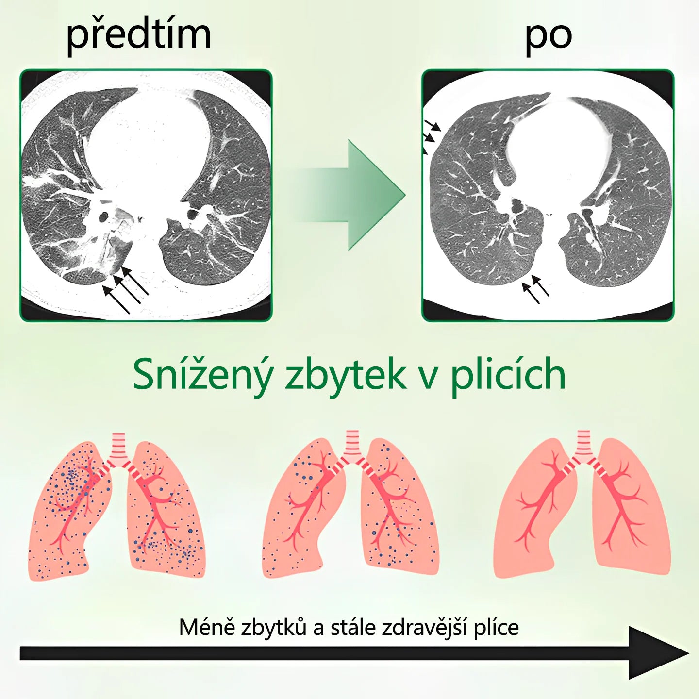 Malenia® Pokročilý plicní čisticí sprej ✨✨