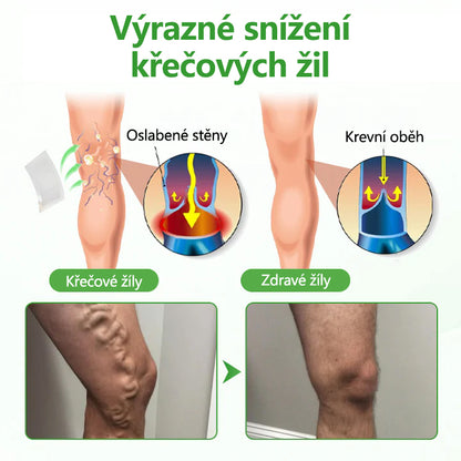 🌿Malenia® VeinHeal mikrojehličková náplast