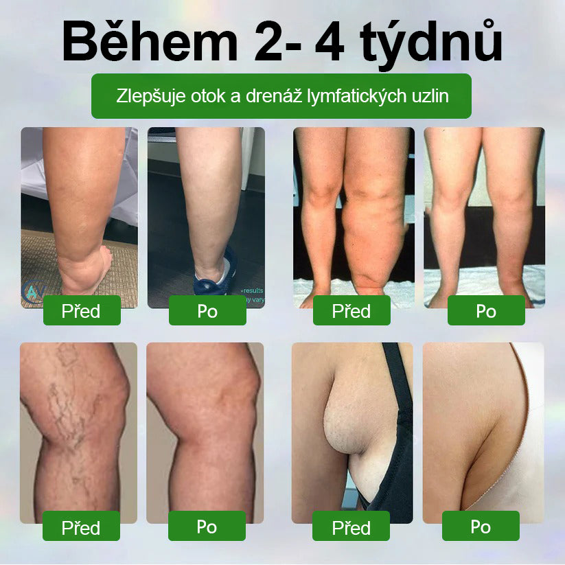 🌿🌿🌿Malenia® Bylinný krém zmírňující otoky s černuchou
