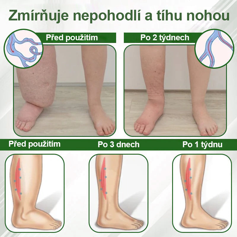 🌿🌿🌿Malenia® Bylinný krém zmírňující otoky s černuchou
