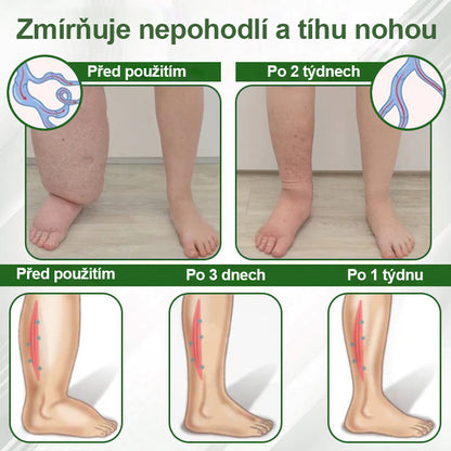 🌿🌿🌿Malenia® Bylinný krém zmírňující otoky s černuchou