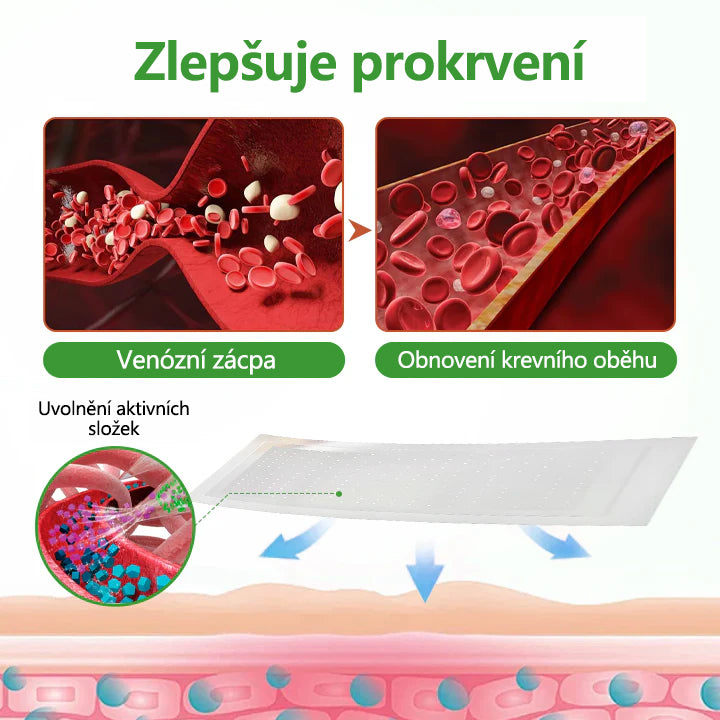🌿Malenia® VeinHeal mikrojehličková náplast