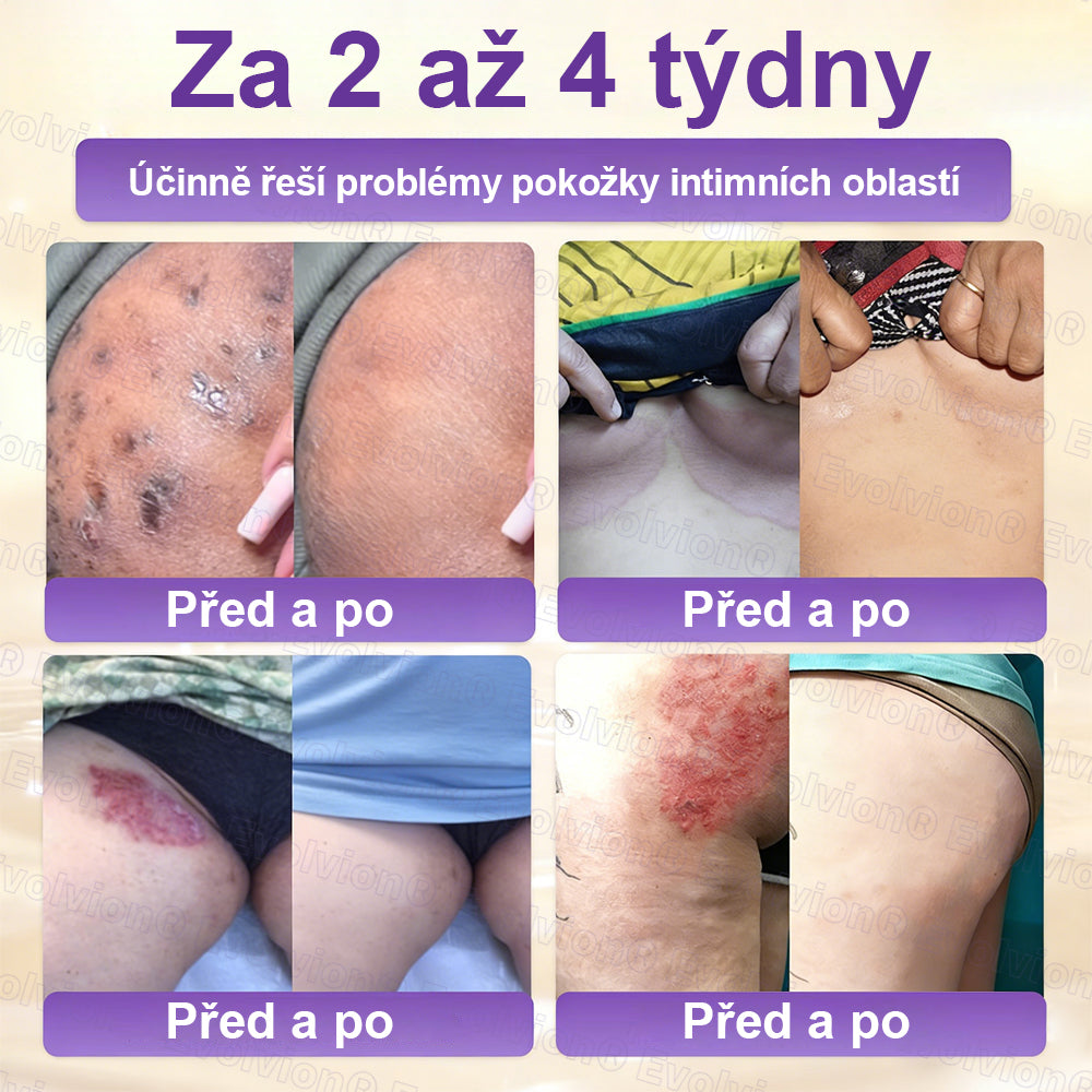 Malenia® Biotin 10 v 1 pleťový regenerační krém✨