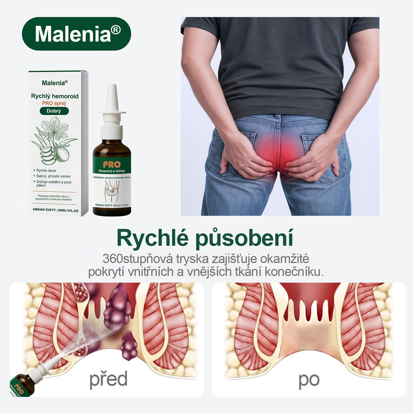 🎁🎁Malenia® Rychlý sprej proti hemoroidům PRO