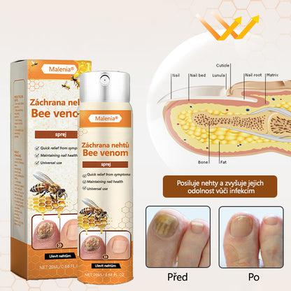 🔥🔥🔥Malenia® NailRescue Včelí jed ve spreji