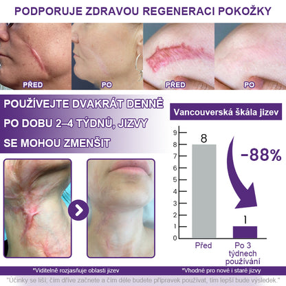 🔥🔥Malenia® ReGenScar Gel na jizvy s kmenovými buňkami