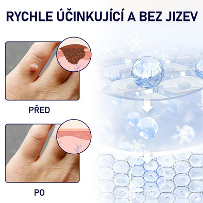 🔥🔥Malenia® WartErase Kryogenní sprej