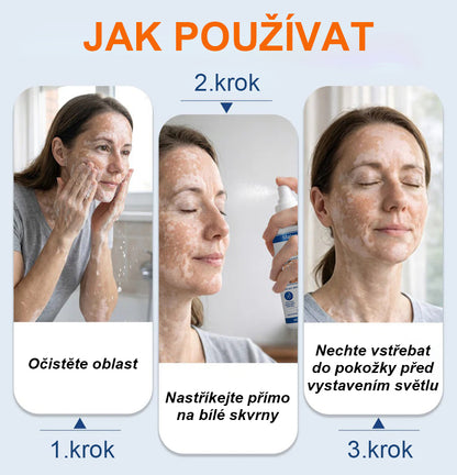🌿🌿Malenia® Piperin Repigmentační aktivační sprej