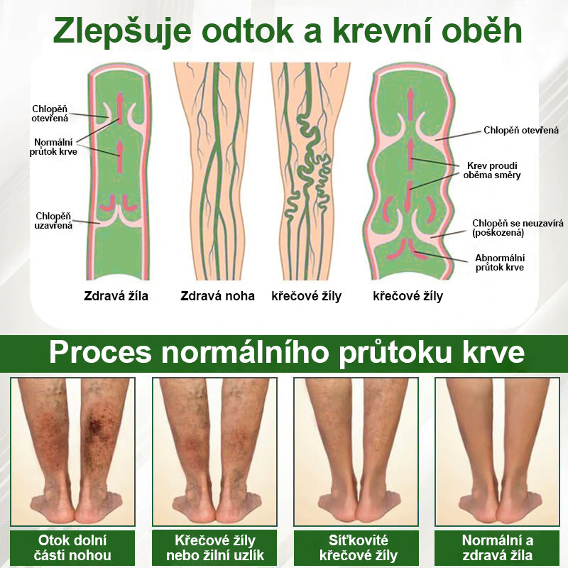 🌿🌿🌿Malenia® Bylinný krém zmírňující otoky s černuchou