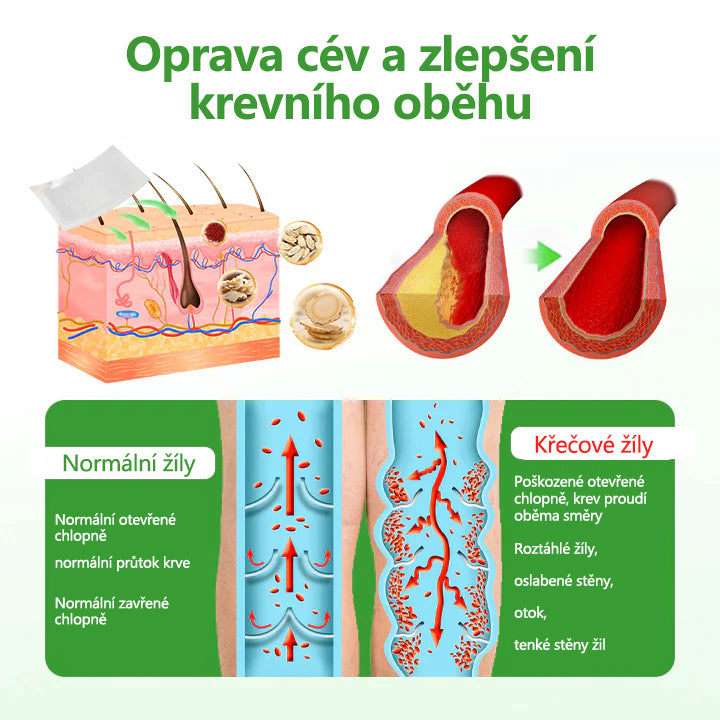 🌿Malenia® VeinHeal mikrojehličková náplast