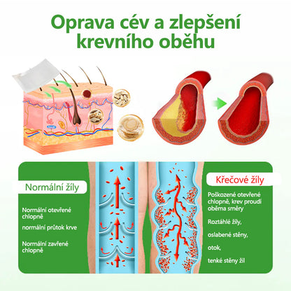 🌿Malenia® VeinHeal mikrojehličková náplast