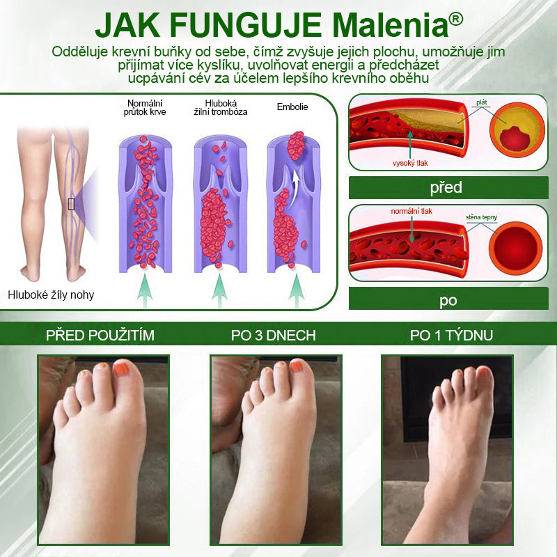 🌿🌿🌿Malenia® Bylinný krém zmírňující otoky s černuchou