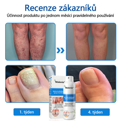 【Oficiální značkový obchod】✅✅Malenia® Magnesium bylinný sprej