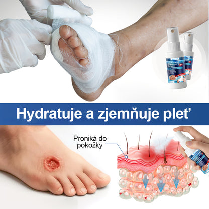 Malenia® GlucoDerm bariérový sprej✨✨