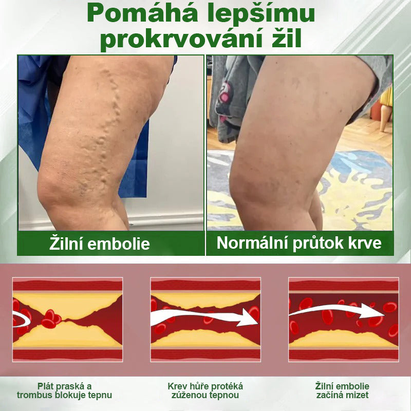 🌿🌿🌿Malenia® Bylinný krém zmírňující otoky s černuchou