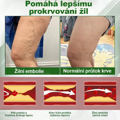 🌿🌿🌿Malenia® Bylinný krém zmírňující otoky s černuchou