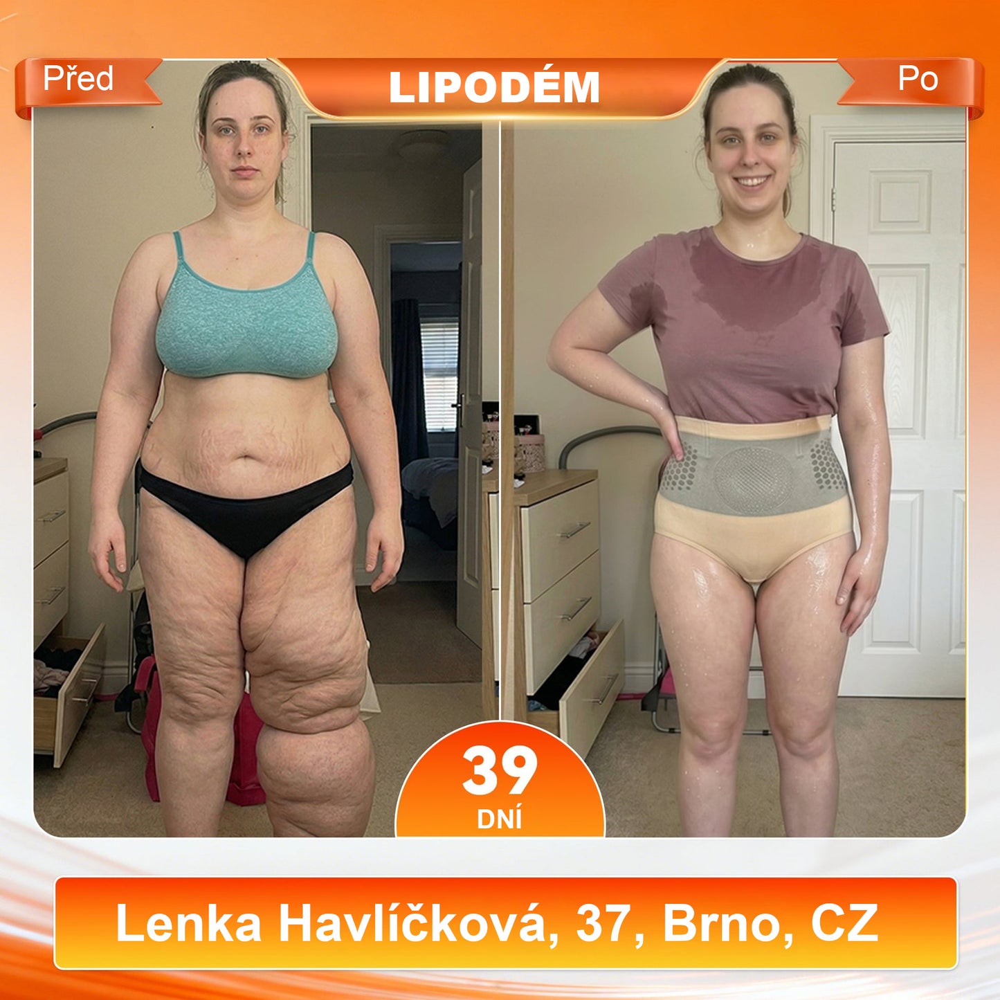 Malenia® 2026 Moringa & Berberine 4-v-1 Mikročásticové tvarovací a spalovač tuků šortky🛡️