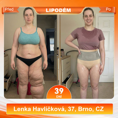 Malenia® 2026 Moringa & Berberine 4-v-1 Mikročásticové tvarovací a spalovač tuků šortky🛡️
