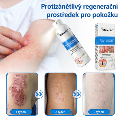 【Oficiální značkový obchod】✅✅Malenia® Magnesium bylinný sprej