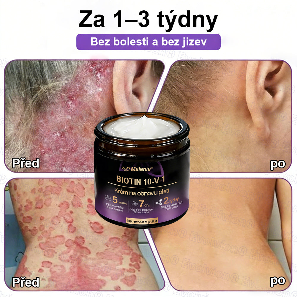 Malenia® Biotin 10 v 1 pleťový regenerační krém✨
