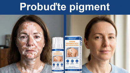 🌿🌿Malenia® Piperin Repigmentační aktivační sprej