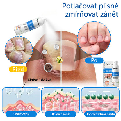 【Oficiální značkový obchod】✅✅Malenia® Magnesium bylinný sprej
